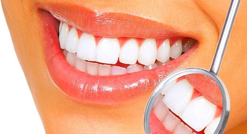 От улыбки станет всем светлей! Ультразвуковая чистка зубов AirFlow со скидкой 83% в стоматологической клинике «Айболит» .