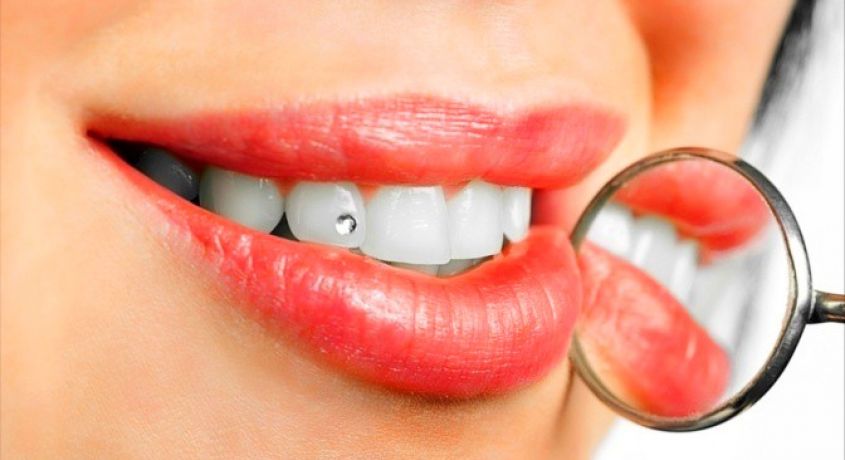 От улыбки станет всем светлей! Ультразвуковая чистка зубов AirFlow со скидкой 83% в стоматологической клинике «Айболит» .