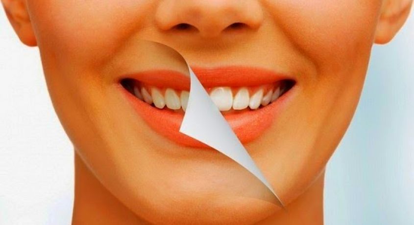 Белоснежную улыбку хотят все. Гигиеническая чистка зубов с полировкой и фторированием со скидкой 50% от стоматологии «Кристалл».
