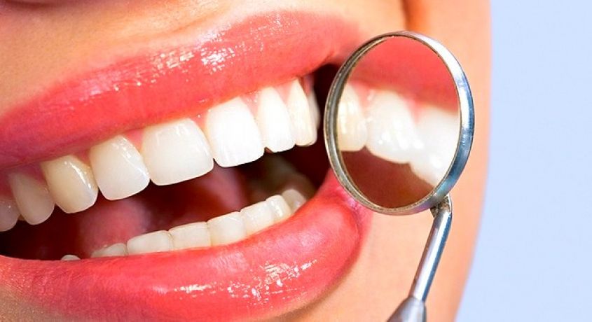 Белоснежную улыбку хотят все. Гигиеническая чистка зубов с полировкой и фторированием со скидкой 50% от стоматологии «Кристалл».