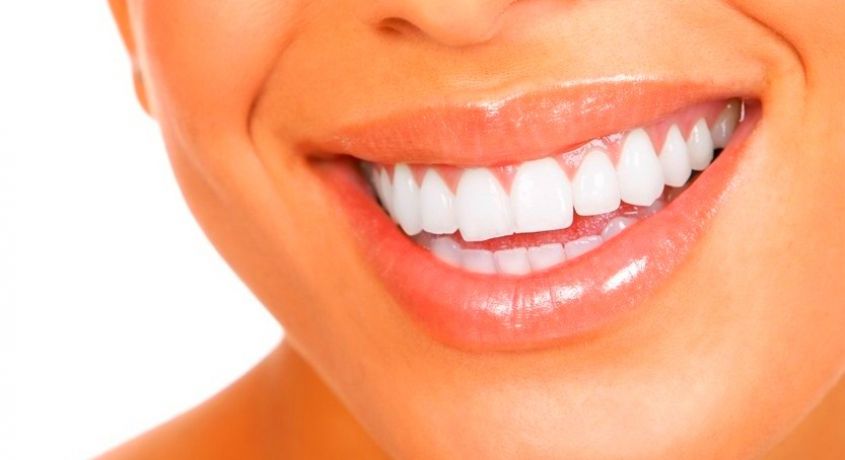 Ослепительная улыбка! Скидка 50% на гигиеническую чистку зубов и отбеливание «Air-Flow» от стоматологии «Улыбка Плюс».