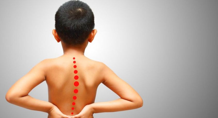 Лечебный массаж! Детский массаж при вальгусе стоп, сутулости, сколиозе и искривлении позвоночника с консультацией ортопеда 70%.