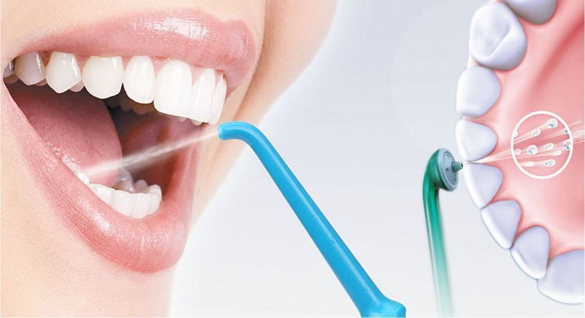 Улыбайтесь чаще! Ультразвуковая чистка зубов со скидкой 60% в стоматологической клинике «Акула»!