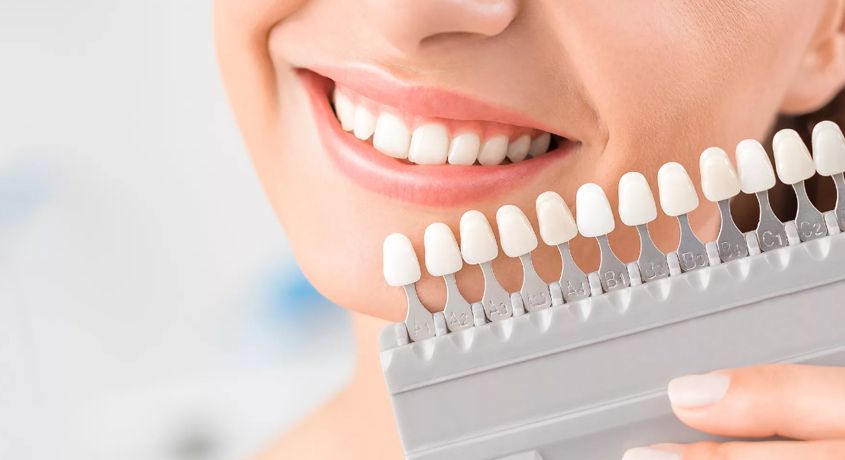 Отбеливание зубов с применением системы Amazing White со скидкой 50% от стоматологической клиники «Oxford Smile»!