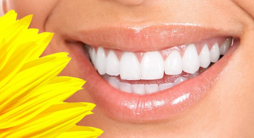 Отбеливание зубов Amazing White со скидкой 50% от Стоматологической клиники «Лэна-Дент»