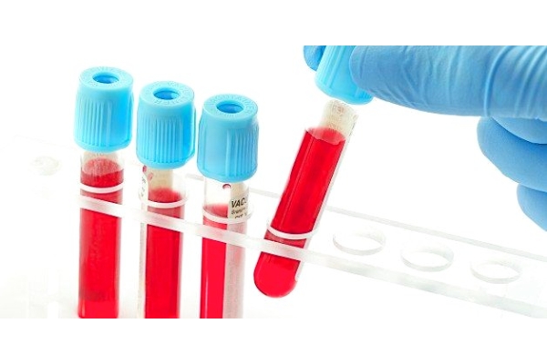 Общий клинический анализ крови + Лейкоцитарная формула + СОЭ    