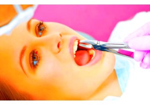 Удаление постоянного подвижного зуба