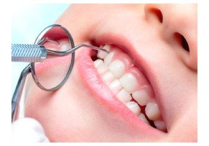 Лечение пульпита постоянного зуба (4 канала) + полная реставрация (2 посещение)