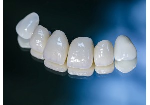 Металлокерамическая коронка на зуб 