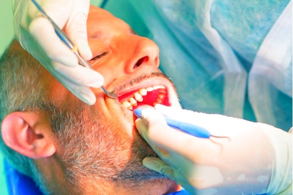 Удаление многокоренного зуба (средней сложности)