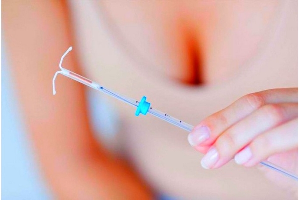 Введение внутриматочного контрацептива (без стоимости ВМК)