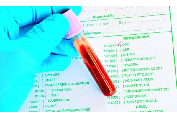 Клинический анализ крови