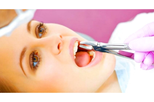 Удаление зуба простое (с применением пьезохирургического аппарата)