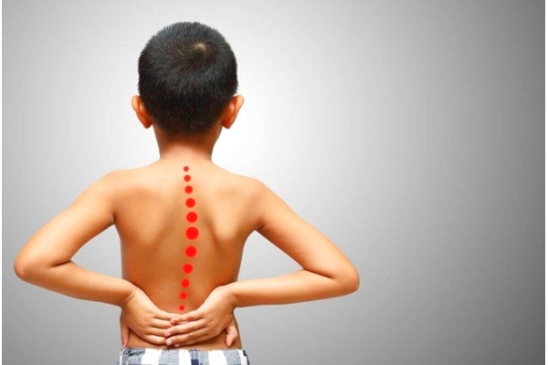 Лечение асимметрии мышц спины у детей
