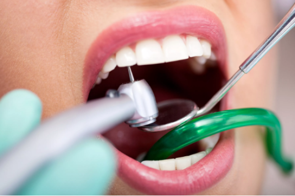Лечение периодонтита зуба 