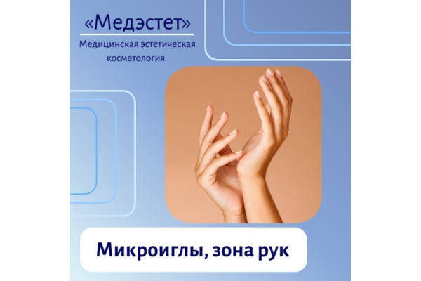 Радиочастотная термоабляция рук микроиглы