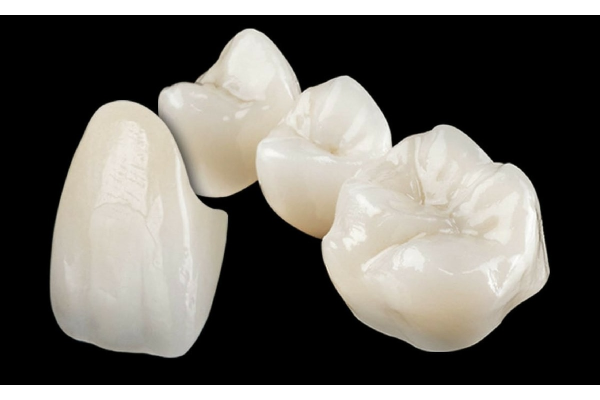 Коронка керамическая на передние зубы 