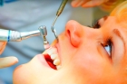 Профессиональная полировка зубов специализированными пастами и щетками (обе челюсти)