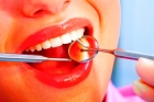 Эстетическое восстановление формы зуба простое