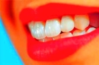 Восстановление зуба под коронку меньше ½ зуба