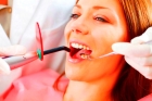 Лечение периодонтита 2-канального зуба
