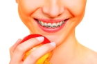 Профессиональная чистка зубов с брекетами  (со снятием и установкой дуги) 1 зубной ряд