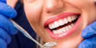 Удаление зубных отложений ультразвуком