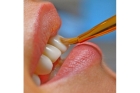Косметическая реставрация зубов