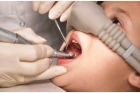 Лечение зуба у детей под седацией
