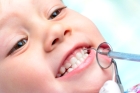 Лечение кариеса временных зубов