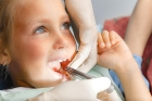  Удаление зуба у ребенка