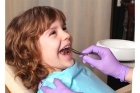  Фторирование зубов детям