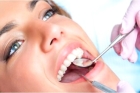 Восстановление зуба реставрационным материалом (III, V, VI класс)