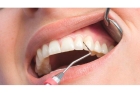 Лечение десен зубов