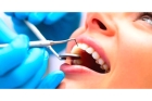 Лечение пульпита 2 канального зуба