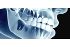 Рентген корней зубов