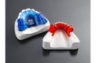 Ортодонтическая коррекция съемным ортодонтическим аппаратом (Твин Блок)