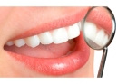 Лечение гипертензии эмали (глубокое фторирование эмали 1-го зуба ЭГЛ)