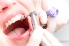 Протезирование зубов на имплантах дешево