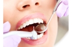 Протезирование зубов на имплантах по акции