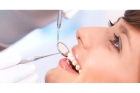 Протезирование зубов на имплантах под ключ