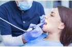 Восстановление зуба пломбой IV класс по Блэку (реставрация)
