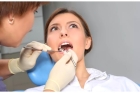 Восстановление зуба пломбой V класс по Блэку