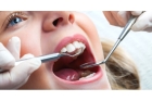Лечение пульпита молочного зуба c эндодонтией (2 посещение)