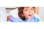 Лечение пульпита постоянного зуба (3 канала) + полная реставрация (1 посещение)
