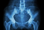 Рентгенография всего таза, подвздошной кости, седалищной кости, лонного сочленения