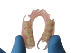 Нейлоновый протез (от 1 до 3 зубов)