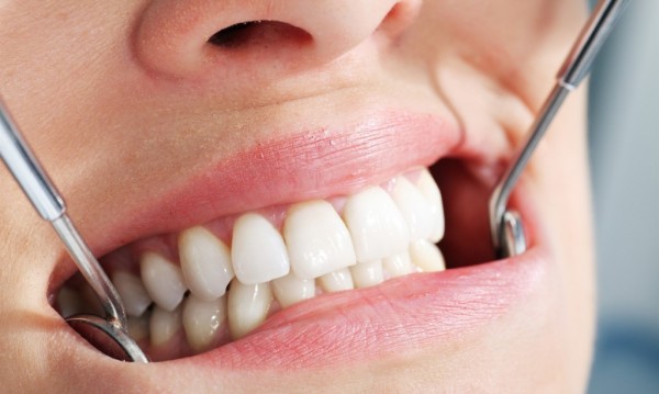 Чем занимается стоматолог-ортопед?