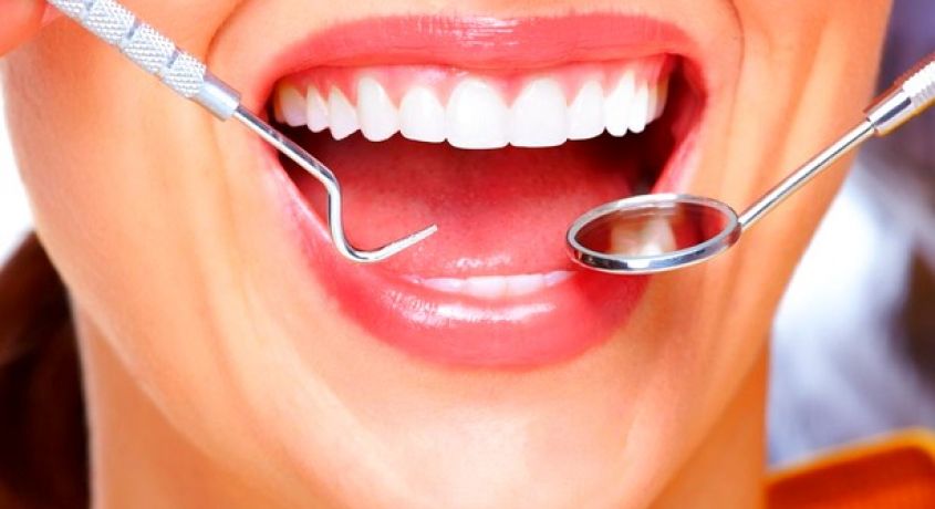 Лечение кариеса и установка светоотверждаемой пломбы на один зуб со скидкой 50% от клиники «Стоматология 33».
