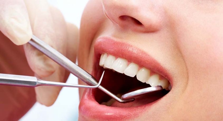 Здоровые зубы-крепкий иммунитет! Скидка 55% на лечение кариеса любой сложности от стоматологии «Академия-М».